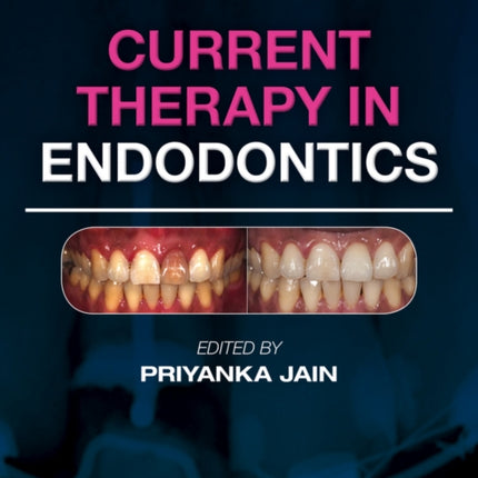 Current Therapy in Endodontics