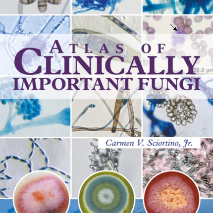 Atlas of Clinically Important Fungi