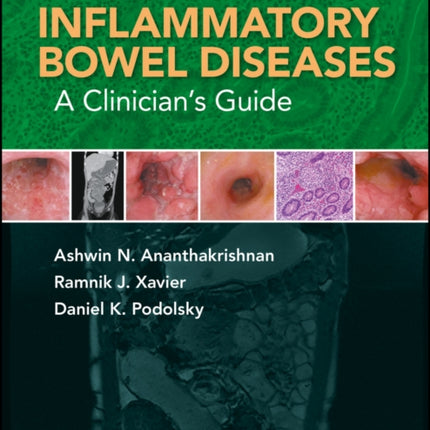 Inflammatory Bowel Diseases