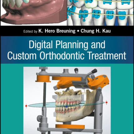 Digital Planning and Custom Orthodontic Treatment