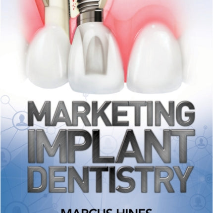 Marketing Implant Dentistry: Attract and Influence Patients to Accept Your Dental Implant Treatment Plan