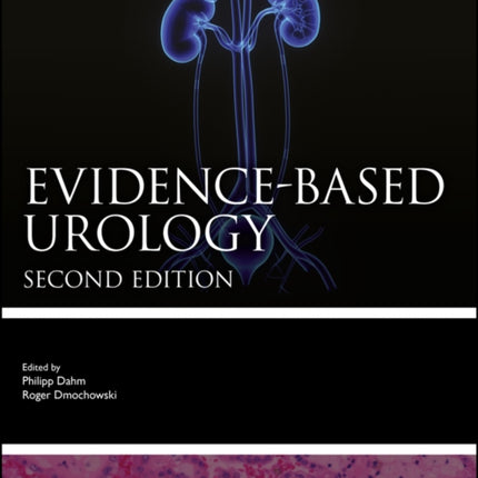 Evidencebased Urology