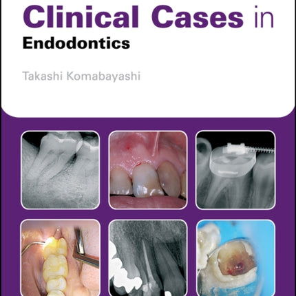 Clinical Cases in Endodontics