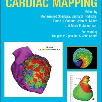 Cardiac Mapping