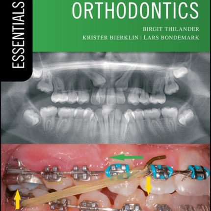 Essential Orthodontics