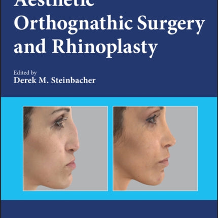 Aesthetic Orthognathic Surgery and Rhinoplasty