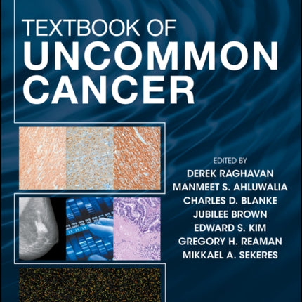 Textbook of Uncommon Cancer