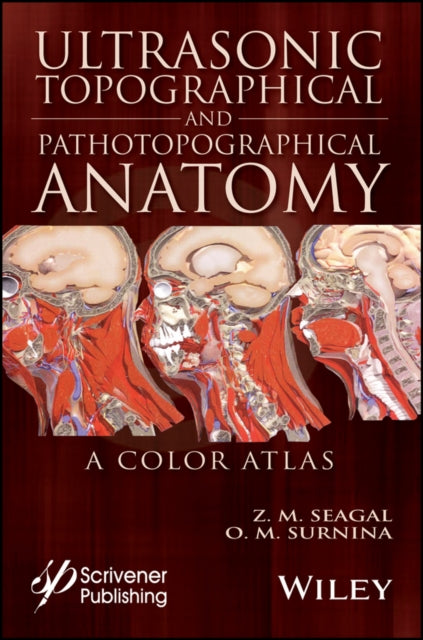 Ultrasonic Topographical and Pathotopographical Anatomy: A Color Atlas