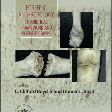 Forensic Anthropology: Theoretical Framework and Scientific Basis