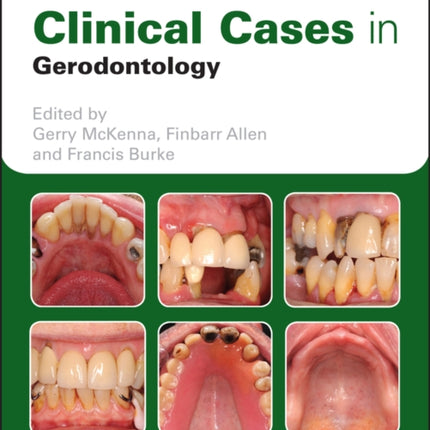 Clinical Cases in Gerodontology