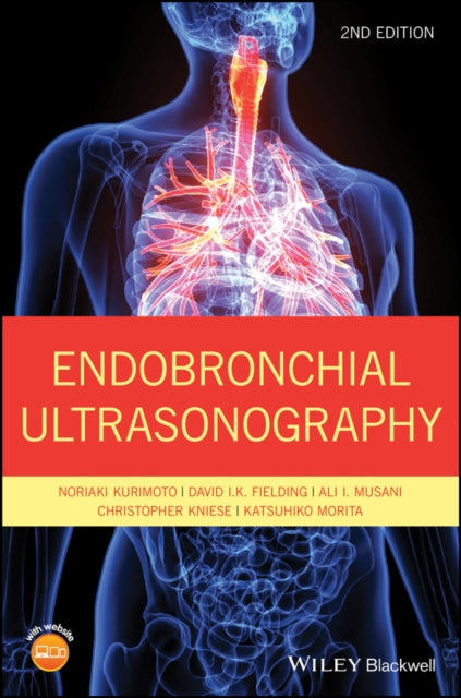 Endobronchial Ultrasonography