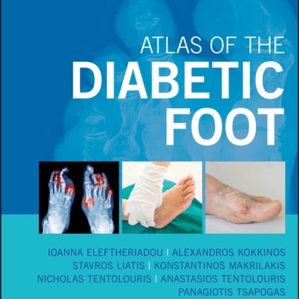 Atlas of the Diabetic Foot
