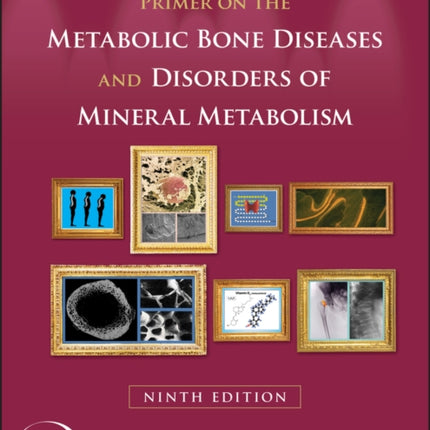 Primer on the Metabolic Bone Diseases and Disorders of Mineral Metabolism