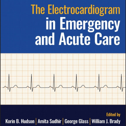 The Electrocardiogram in Emergency and Acute Care