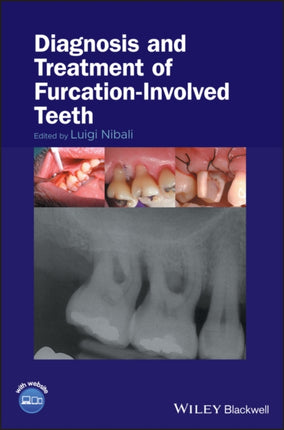 Diagnosis and Treatment of FurcationInvolved
