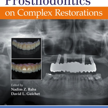 Journal of Prosthodontics on Complex Restorations