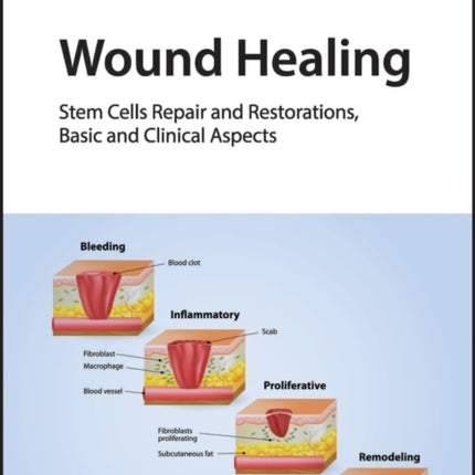 Wound Healing: Stem Cells Repair and Restorations, Basic and Clinical Aspects