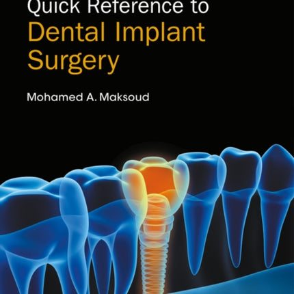 Quick Reference to Dental Implant Surgery