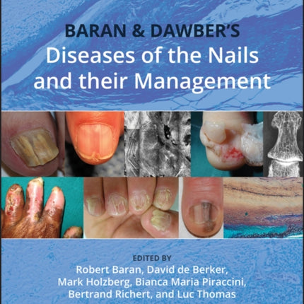 Baran and Dawbers Diseases of the Nails and their