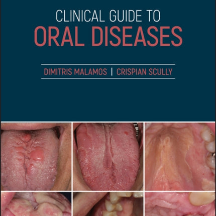 Clinical Guide to Oral Diseases