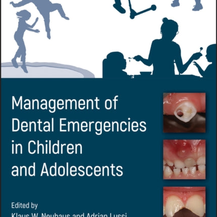 Management of Dental Emergencies in Children and