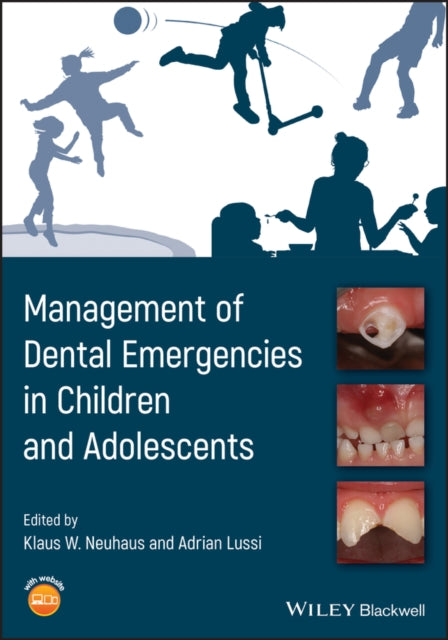 Management of Dental Emergencies in Children and