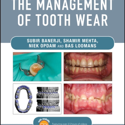 Practical Procedures in the Management of Tooth