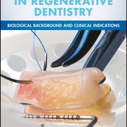 Platelet Rich Fibrin in Regenerative Dentistry