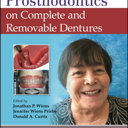 Journal of Prosthodontics on Complete and Removable Dentures