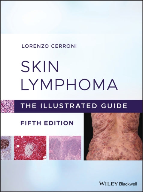 Skin Lymphoma: The Illustrated Guide