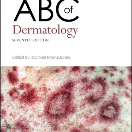 ABC of Dermatology