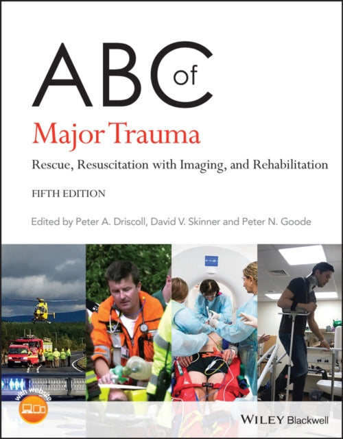 ABC of Major Trauma: Rescue, Resuscitation with Imaging, and Rehabilitation