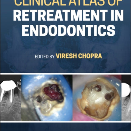 Clinical Atlas of Retreatment in Endodontics