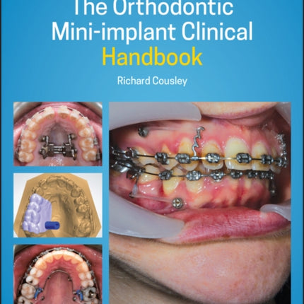 The Orthodontic Mini-implant Clinical Handbook