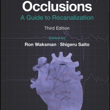 Chronic Total Occlusions: A Guide to Recanalization