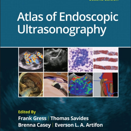 Atlas of Endoscopic Ultrasonography