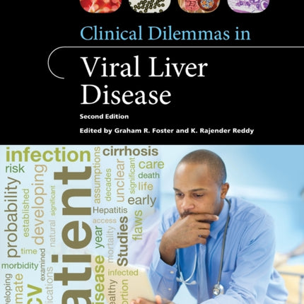 Clinical Dilemmas in Viral Liver Disease