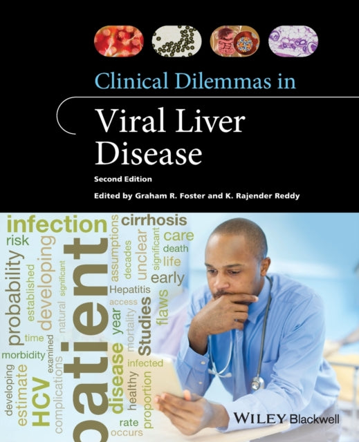 Clinical Dilemmas in Viral Liver Disease