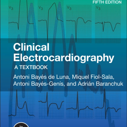 Clinical Electrocardiography: A Textbook