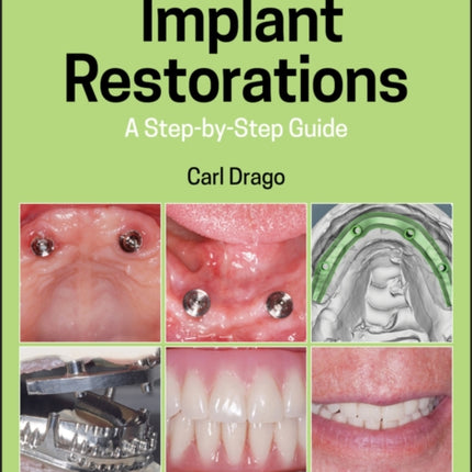 Implant Restorations: A Step-by-Step Guide