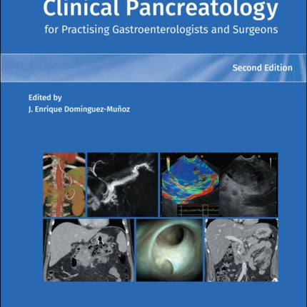 Clinical Pancreatology for Practising Gastroenterologists and Surgeons