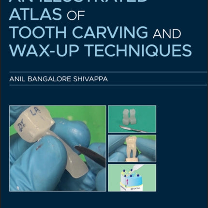 An Illustrated Atlas of Tooth Carving and Wax-Up Techniques