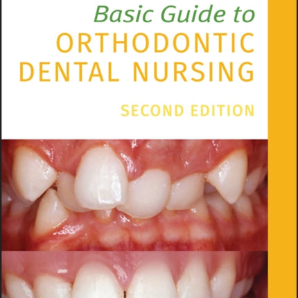 Basic Guide to Orthodontic Dental Nursing