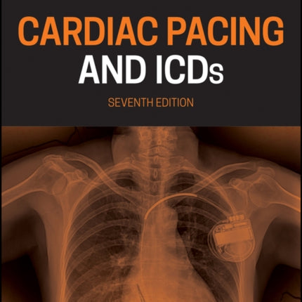 Cardiac Pacing and ICDs