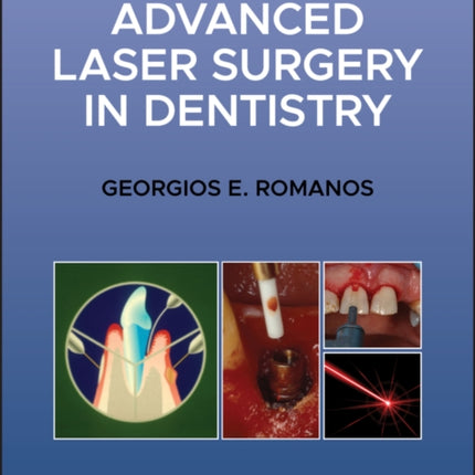 Advanced Laser Surgery in Dentistry