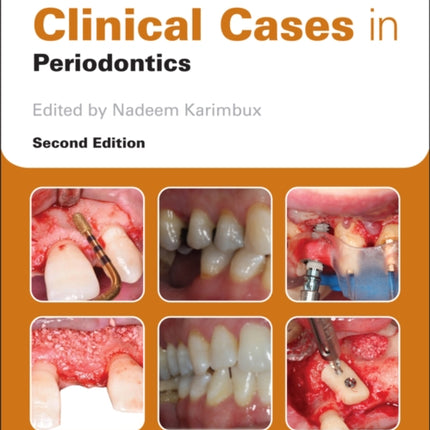 Clinical Cases in Periodontics