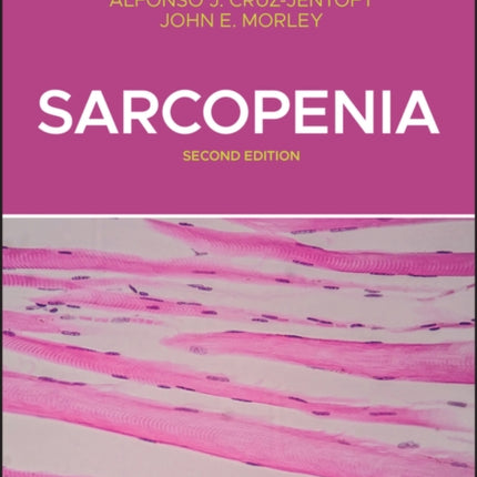 Sarcopenia