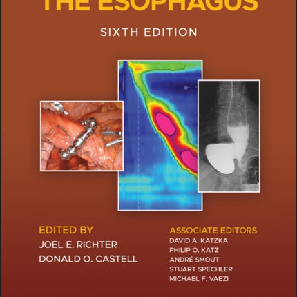 The Esophagus