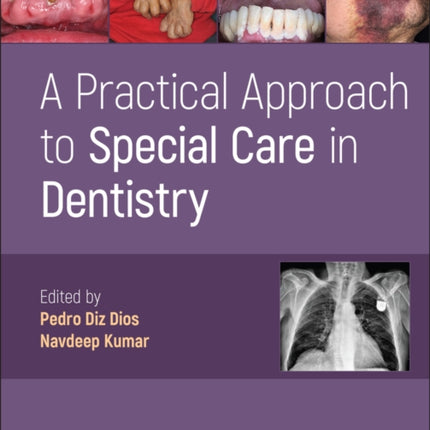 A Practical Approach to Special Care in Dentistry