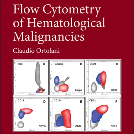 Flow Cytometry of Hematological Malignancies